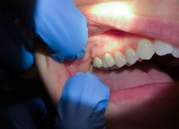 Best Broken Tooth Emergency  in Glenwood, IL